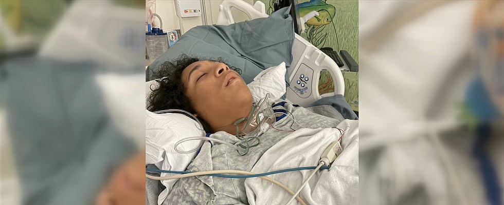 Joziah Thompson, 17, was hospitalized for a week after he contracted Vibrio vulnificus, a...