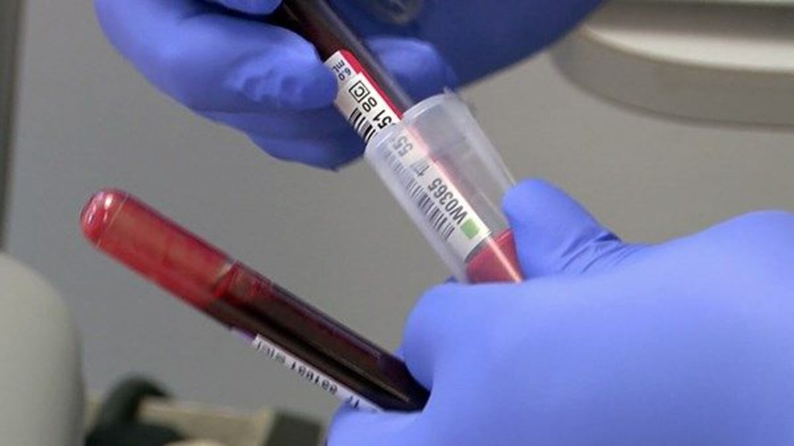 Free STD testing at 43 locations across La., multiple in Baton Rouge