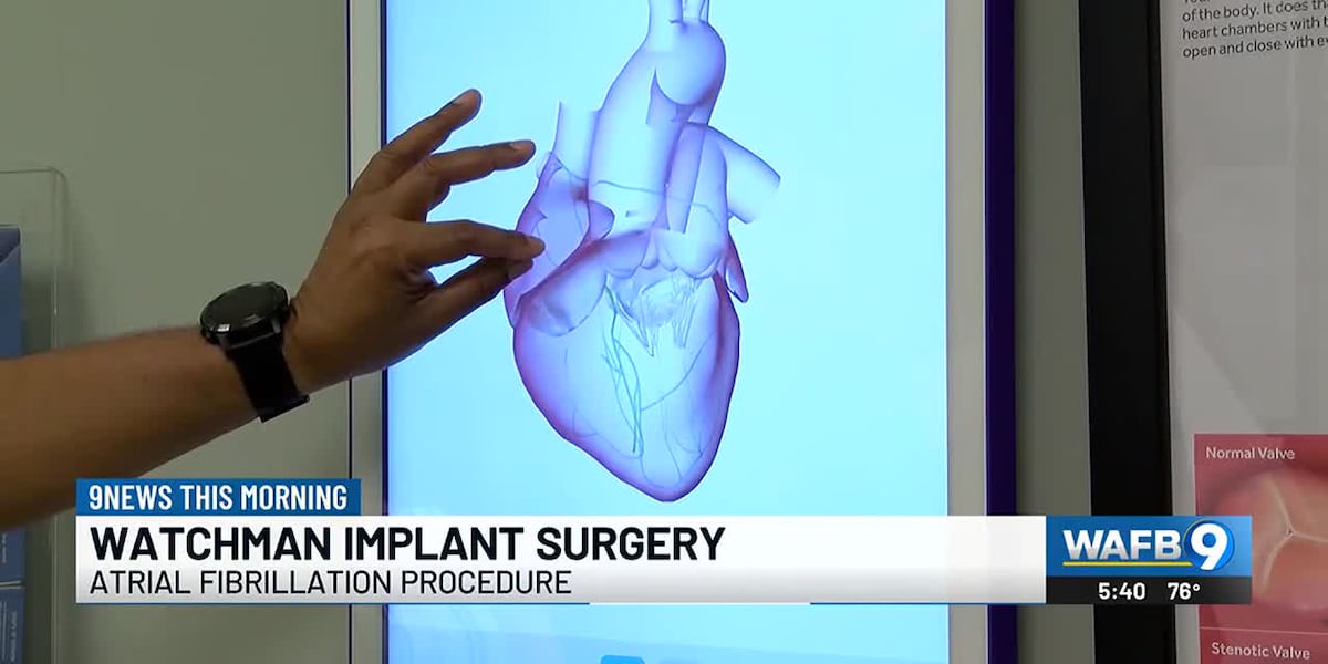 First Generation Watchman Device Watchman Implant Procedure for Atrial Fibrillation